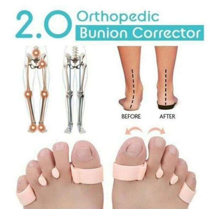 Orthopedische Hallux Valgus Corrector 2.0 (PAAR)