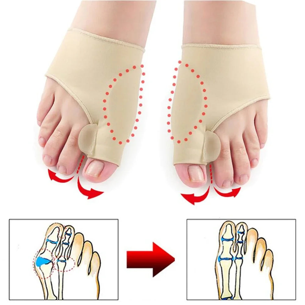 BunionEase Toe Separator Set - Foot Pain Relief Kit