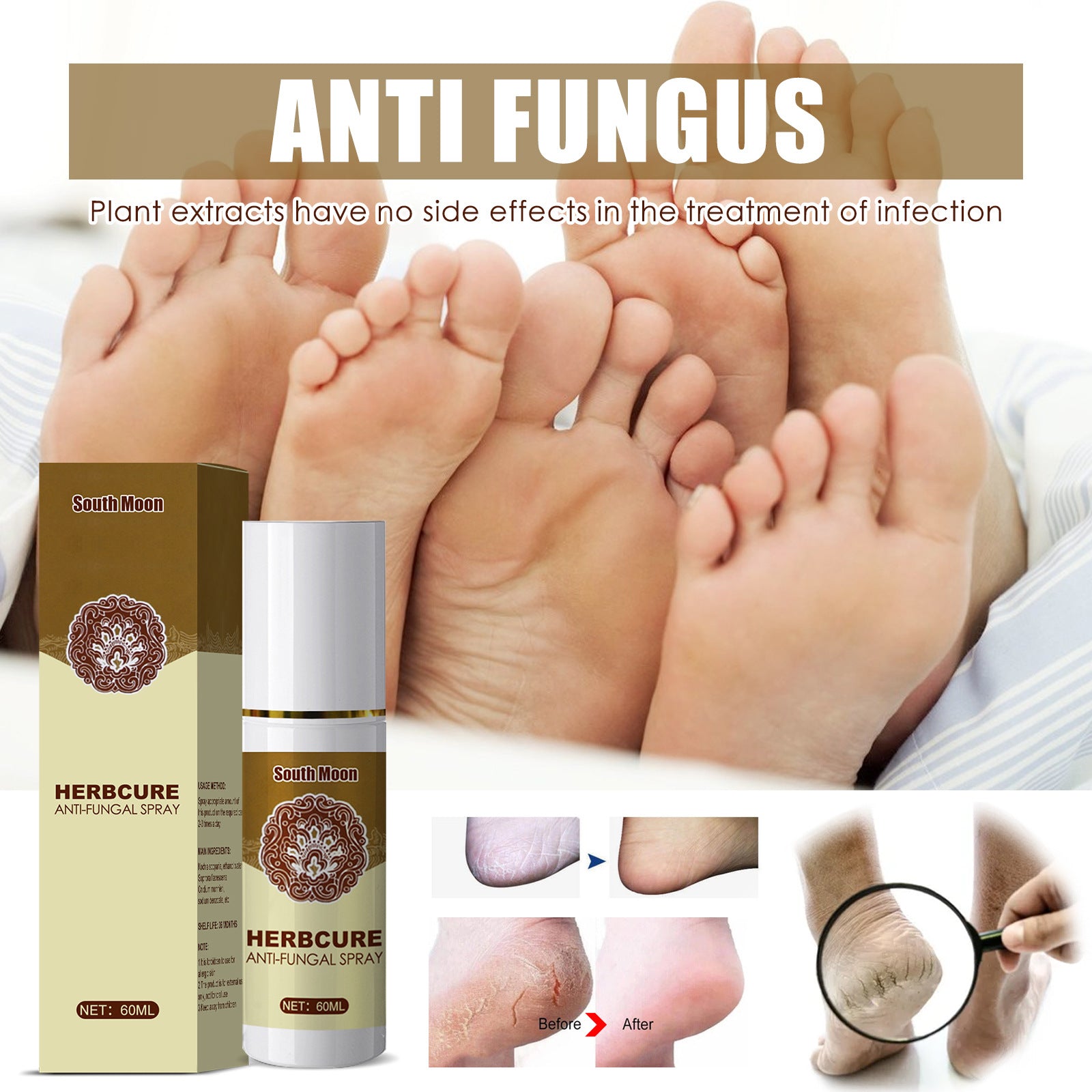 BodiModi's SM® Anti Fungal Spray