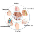 Orthopedische Hallux Valgus Corrector 2.0 (PAAR)
