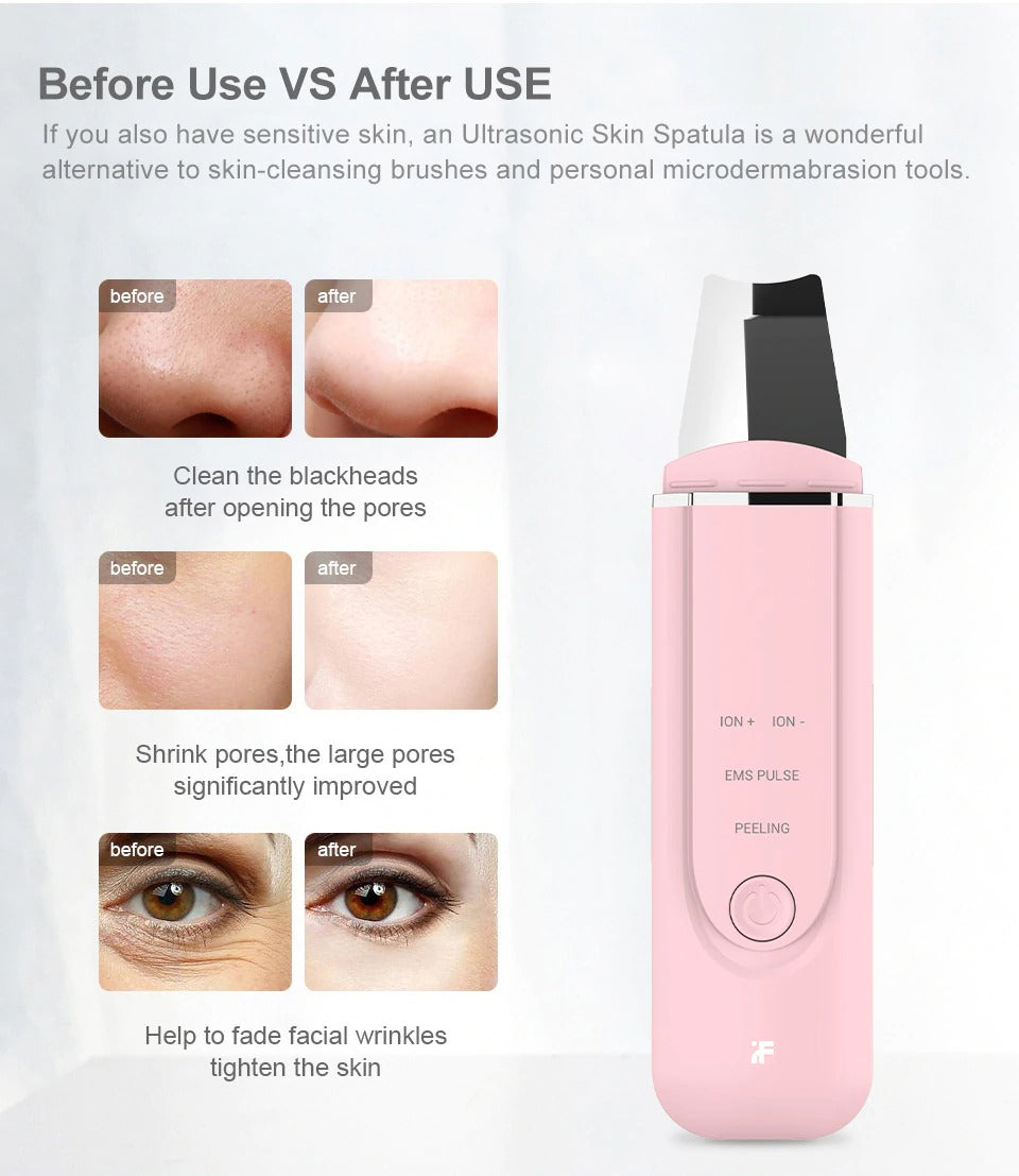 Bodimodi Ultrasonic Face Pore Cleanser