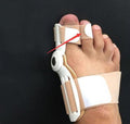 The Bun-Splits Bunion Corrector