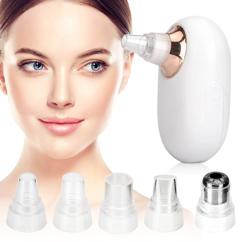 BODIMODI Blackhead Remover Deep Pore Vacuum Cleanser