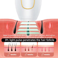 IPL Women and Men at Home Laser Hair Removal Handset
