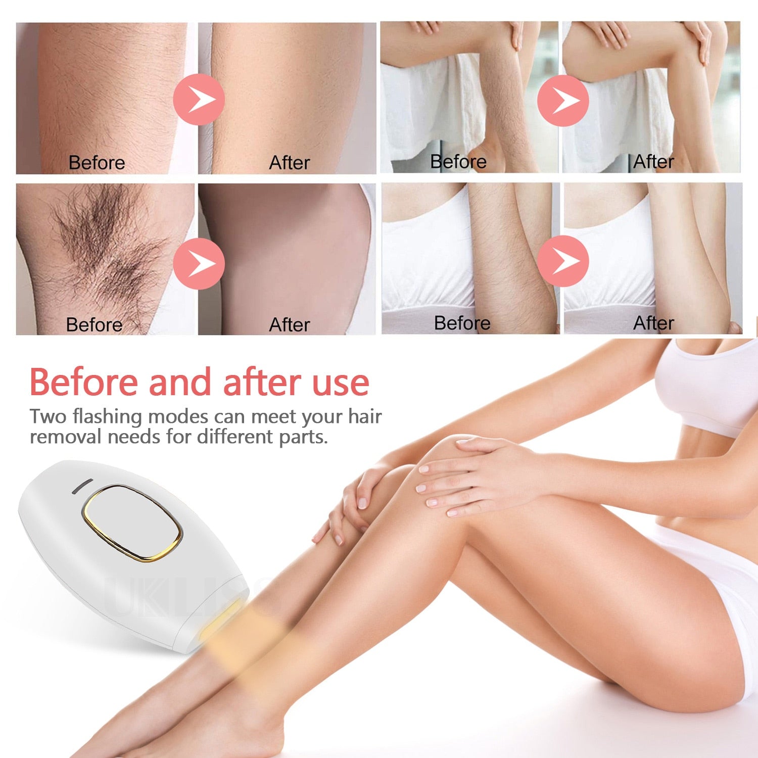 IPL Women and Men at Home Laser Hair Removal Handset